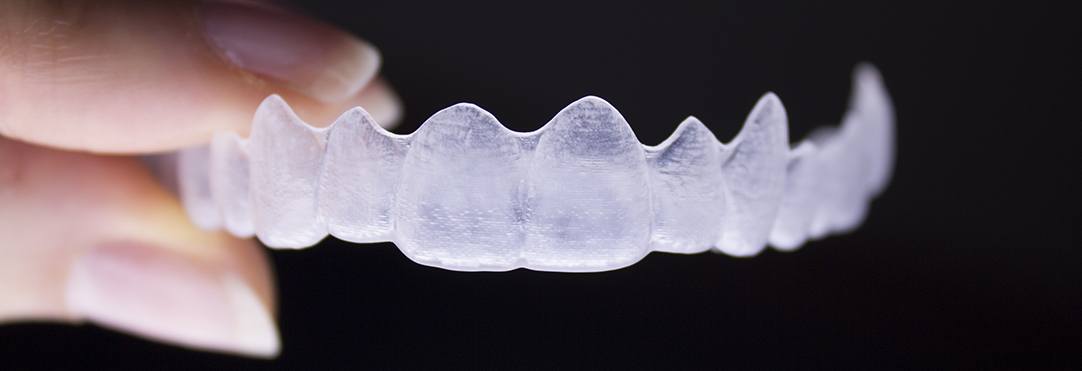 Irvine Clear Aligners