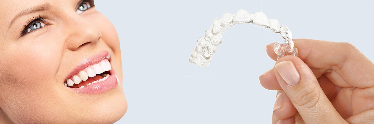 Irvine 7 Things Parents Need to Know About Invisalign Teen
