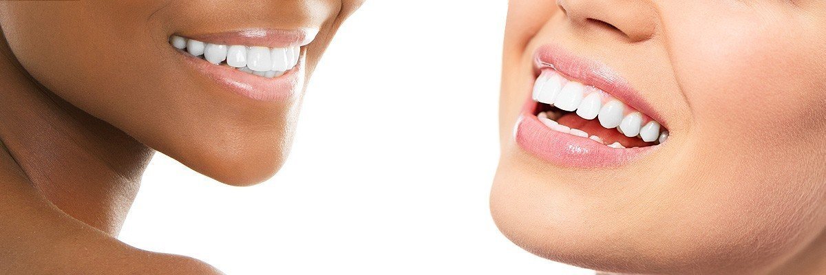 Irvine Dental Restoration