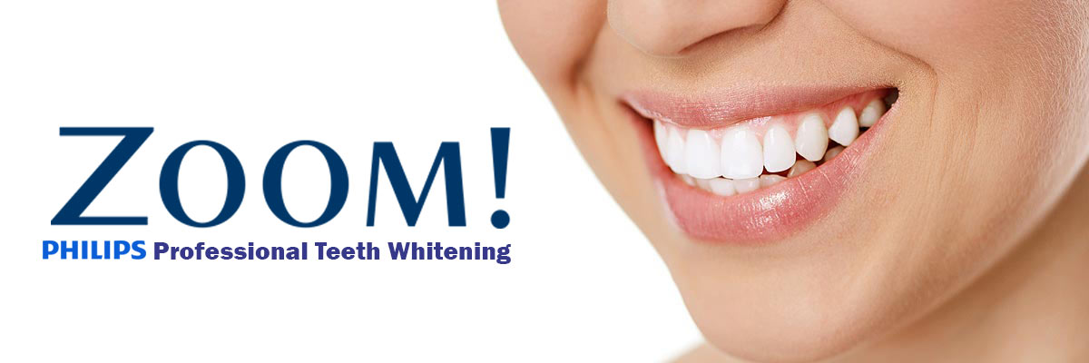Irvine Zoom Teeth Whitening